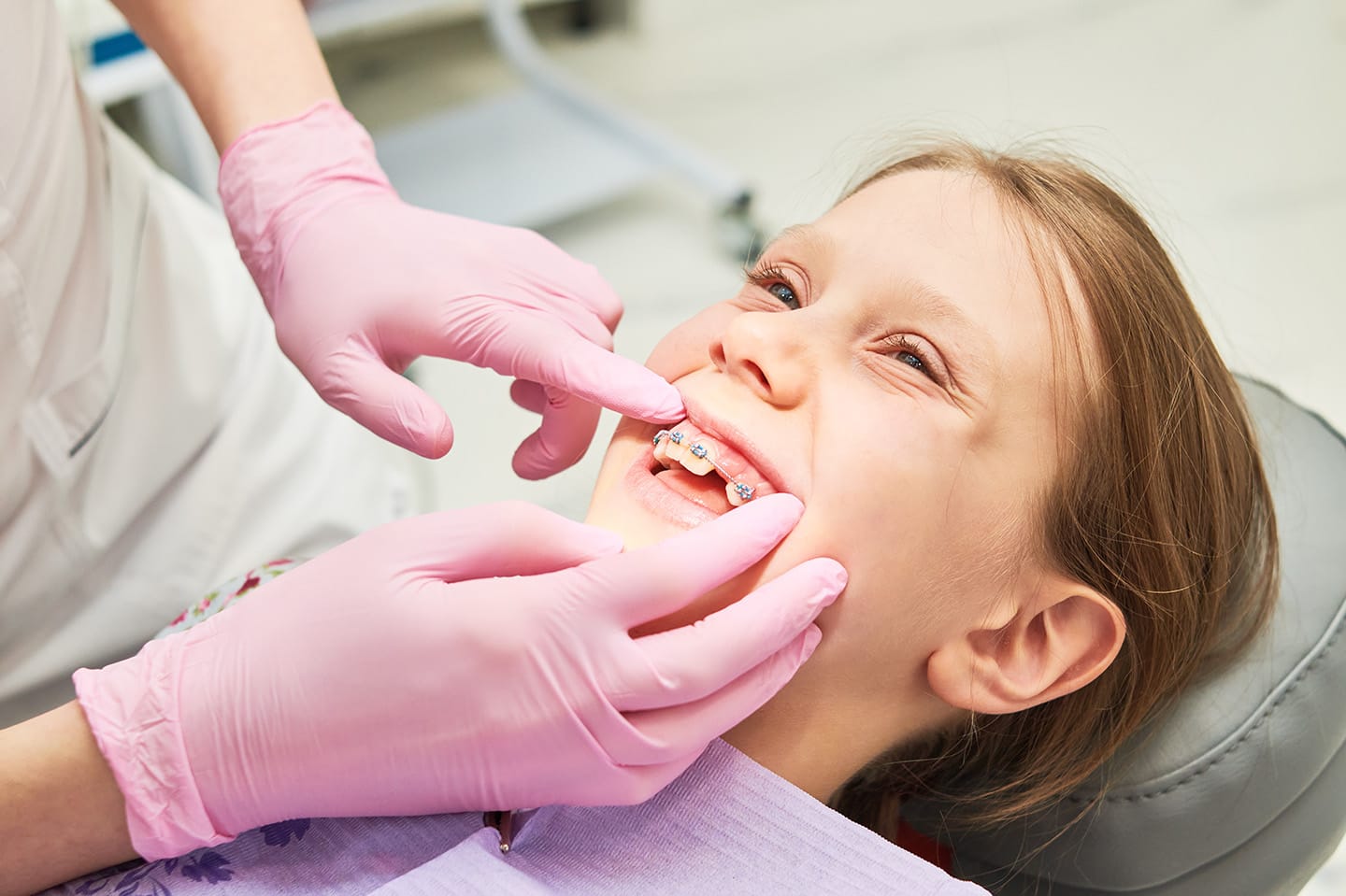 ortodoncia-para-agenesia-dental